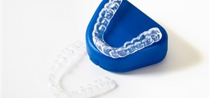 Aligners and Everything You Need to Know About Them