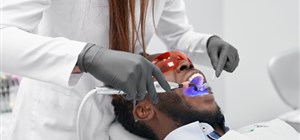 How Often Should You Get a Dental Cleaning? 