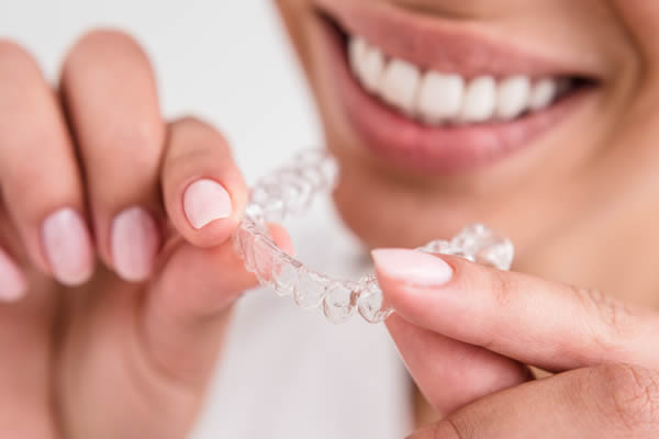 Clear Aligners